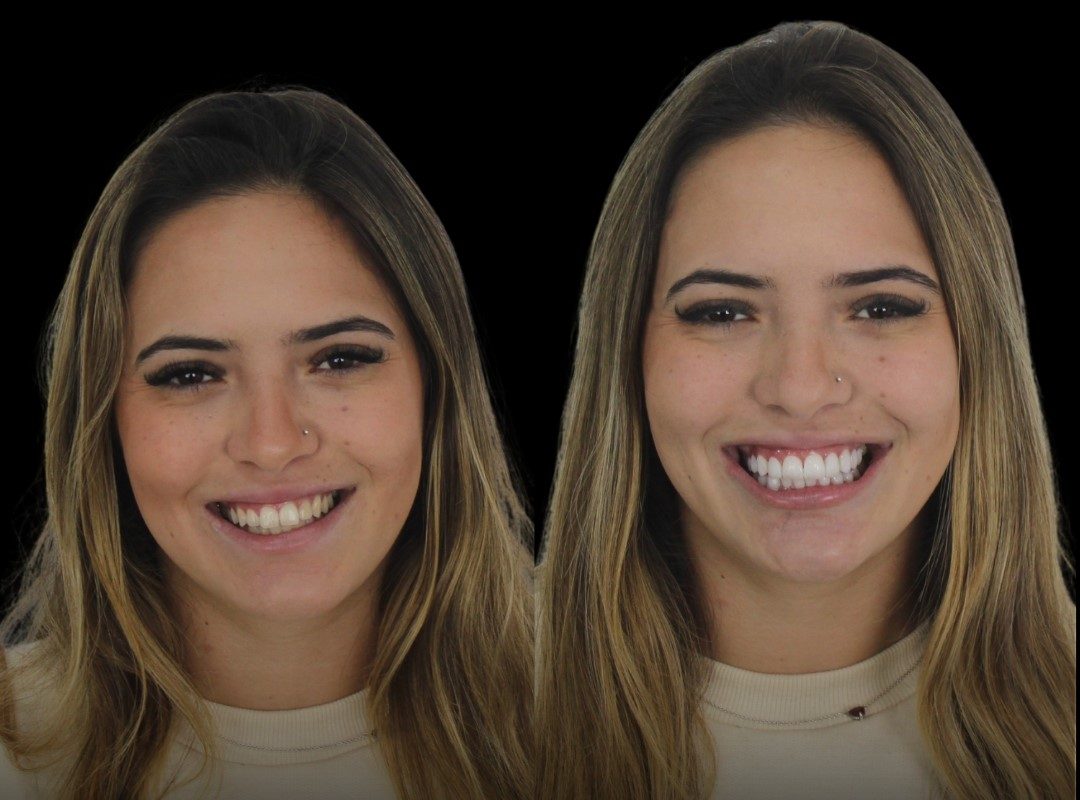 Caso clínico